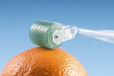Derma roller için tıbbi mikro terapi iğneleme yöntemlerinin etkinliğinin karşılaştırılması