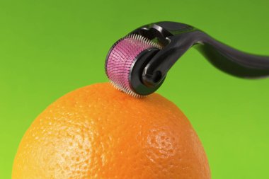 Dermaroller tıbbi Micro terapi iğneleme yöntemlerinin etkinliğinin karşılaştırılması