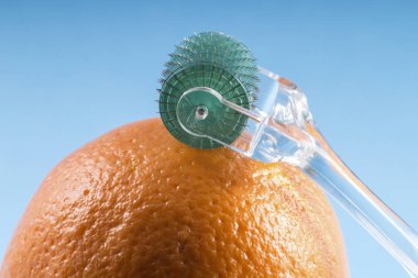 Dermaroller tıbbi Micro terapi iğneleme yöntemlerinin etkinliğinin karşılaştırılması. 