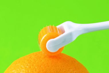 Derma roller için tıbbi mikro terapi iğneleme yöntemlerinin etkinliğinin karşılaştırılması