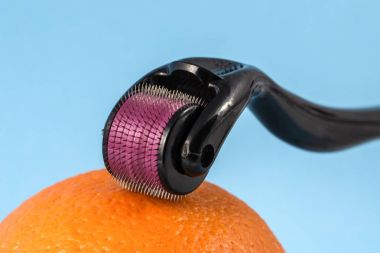 Derma roller için tıbbi mikro terapi iğneleme yöntemlerinin etkinliğinin karşılaştırılması