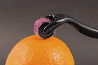 Dermaroller tıbbi Micro terapi iğneleme yöntemlerinin etkinliğinin karşılaştırılması