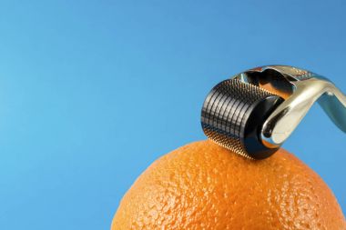 Dermaroller tıbbi Micro terapi iğneleme yöntemlerinin etkinliğinin karşılaştırılması.