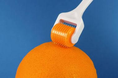 Dermaroller tıbbi Micro terapi iğneleme yöntemlerinin etkinliğinin karşılaştırılması.