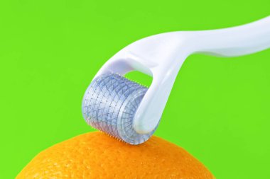 Dermaroller tıbbi Micro terapi iğneleme yöntemlerinin etkinliğinin karşılaştırılması.