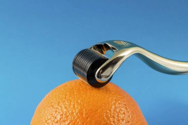 Dermaroller tıbbi Micro terapi iğneleme yöntemlerinin etkinliğinin karşılaştırılması