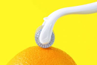 Dermaroller tıbbi Micro terapi iğneleme yöntemlerinin etkinliğinin karşılaştırılması.