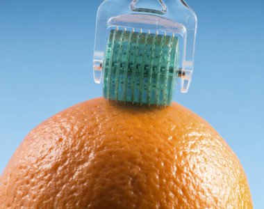 Dermaroller tıbbi Micro terapi iğneleme yöntemlerinin etkinliğinin karşılaştırılması