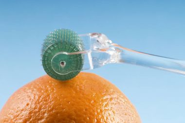 Dermaroller tıbbi Micro terapi iğneleme yöntemlerinin etkinliğinin karşılaştırılması