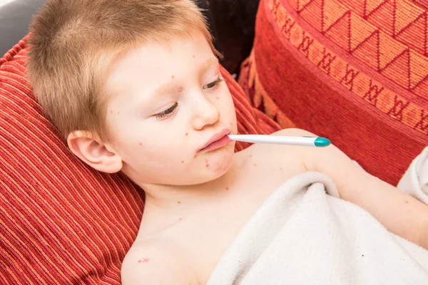 Niño con varicela que mide la fiebre — Foto de Stock