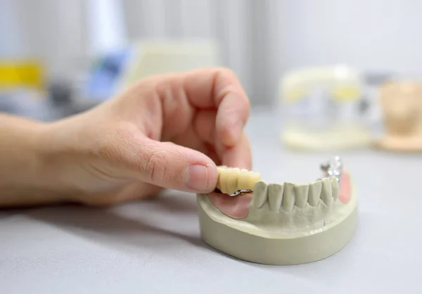 Tandteknikern arbetar — Stockfoto
