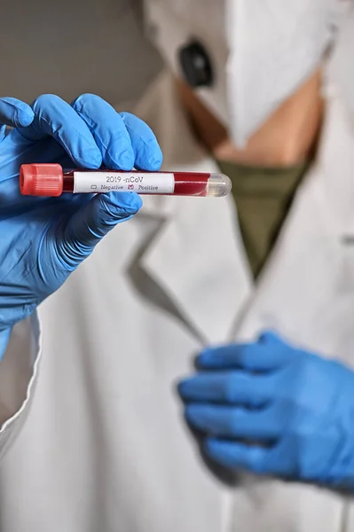 Coronavirus 2019 Ncov Positive Blood Test — Stock Photo, Image