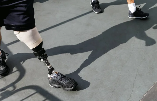 Giovane disabile con protesi ai piedi — Foto Stock