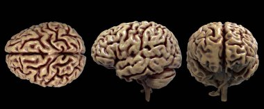 Beyaz arka planda izole edilmiş üç görüntüde insan vücudunun beyin anatomisi - 3 boyutlu görüntüleme
