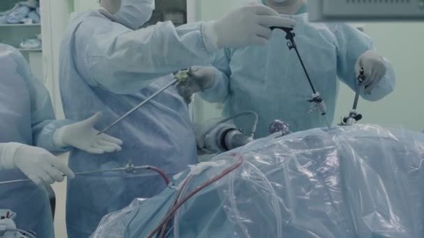 Laparoscopic surgery of the abdomen — Stock Video