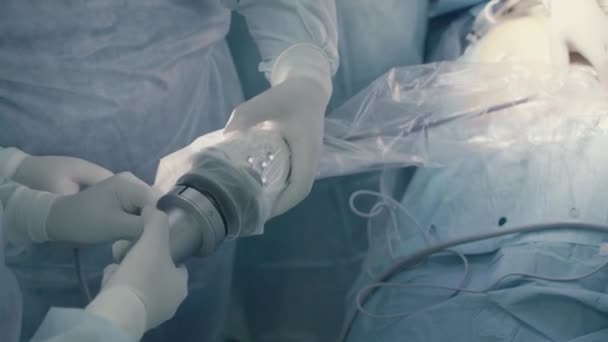 Перед лапароскопической операцией брюшной полости — стоковое видео