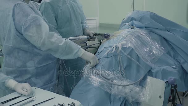 Laparoscopic surgery of the abdomen — Stock Video