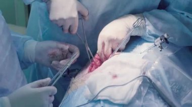 Cerrahi operasyon karın. Dikiş