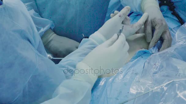 Laparoskopische Chirurgie des Bauches — Stockvideo