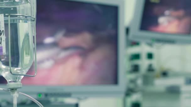 스 포 이트 및 내 시경 수술 하는 동안 모니터 — 비디오