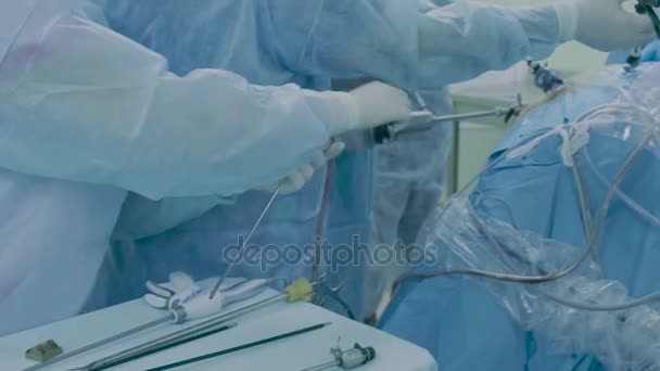 Laparoskopische Chirurgie des Bauches — Stockvideo