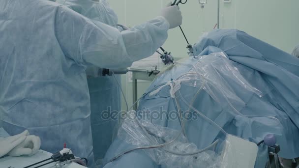 Cirugía laparoscópica del abdomen — Vídeo de stock