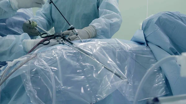 Cirurgia laparoscópica do abdômen — Fotografia de Stock
