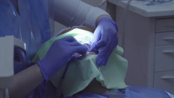 Стоматолог делает клиенту процедуру . — стоковое видео