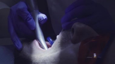 Diş hekimi diş diş Kliniği içinde sondaj