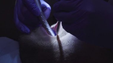 Diş hekimi diş diş Kliniği içinde sondaj