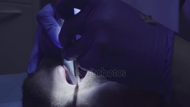 Dentist drilling tooth in dental clinic — Stock Video