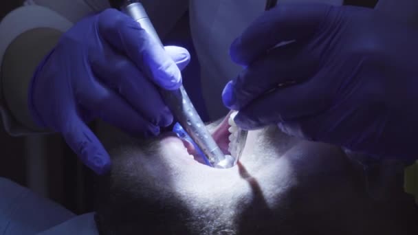 Dentista dente de perfuração na clínica dentária — Vídeo de Stock