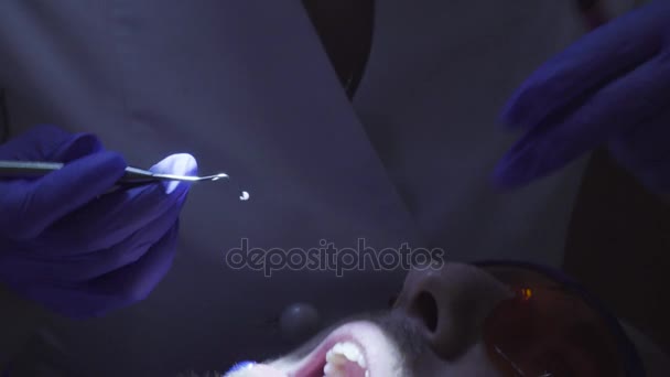 Стоматолог накладывает композитную пломбу на зуб — стоковое видео
