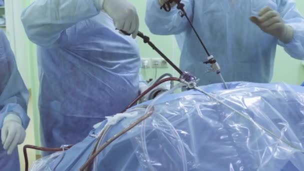 Dos médicos y una enfermera durante la cirugía laparoscópica — Vídeos de Stock