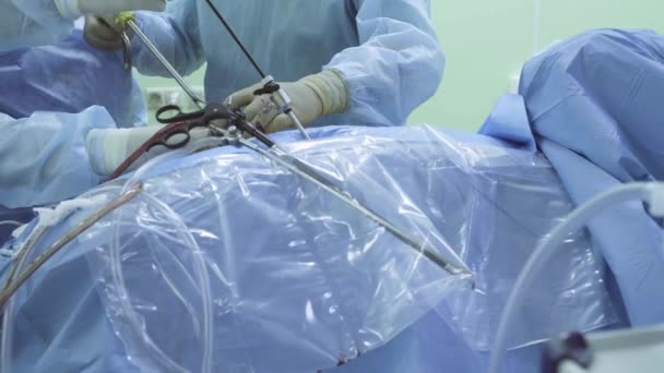 Chirurgie laparoscopique de l'abdomen — Video