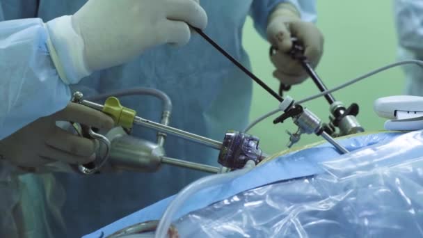 Händerna på två läkare under laparoskopisk operation — Stockvideo