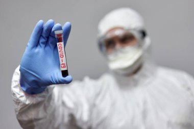 Sağlık görevlisinin elinde kanla test tüpü var.