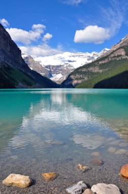 Doğal Lake Louise Kanada