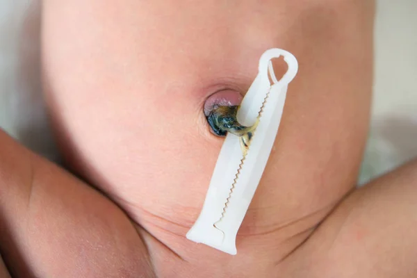 Umbilical cord with clamp of newborn — Stock Photo, Image