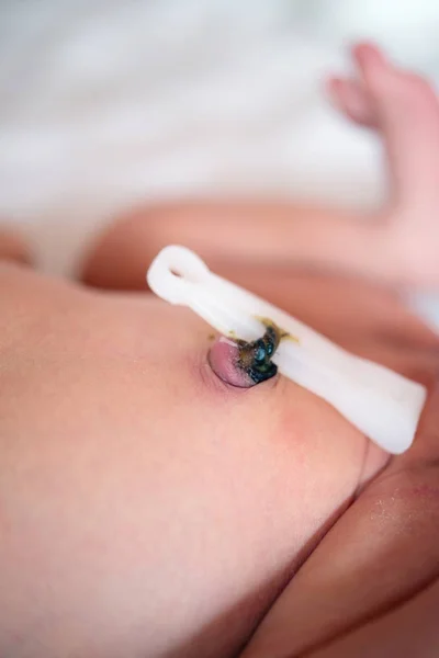 Cordón umbilical con abrazadera del bebé recién nacido — Foto de Stock