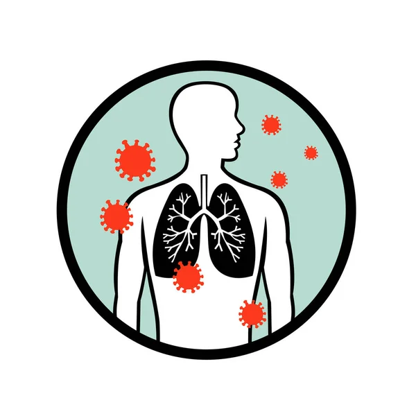 Ilustração Estilo Retrô Células Coronavírus Infectando Pulmões Humanos Sistema Respiratório —  Vetores de Stock