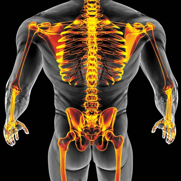 Corpo do homem sob raios-X — Fotografia de Stock