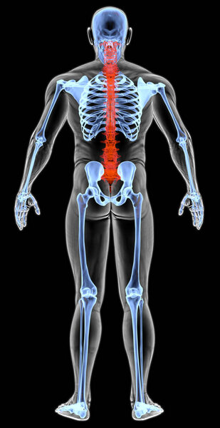 man's body under X-rays