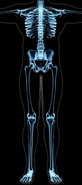 Het lichaam van man onder x-stralen — Stockfoto