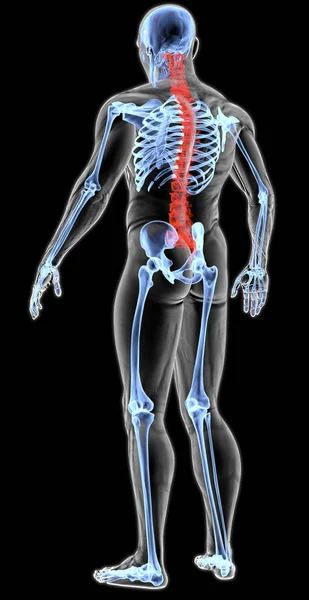 Cuerpo del hombre bajo rayos X — Foto de Stock