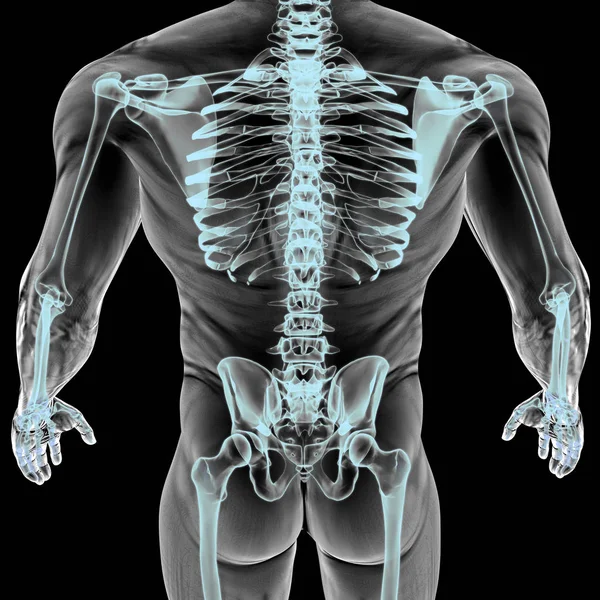 X 線の下で男の身体 — ストック写真