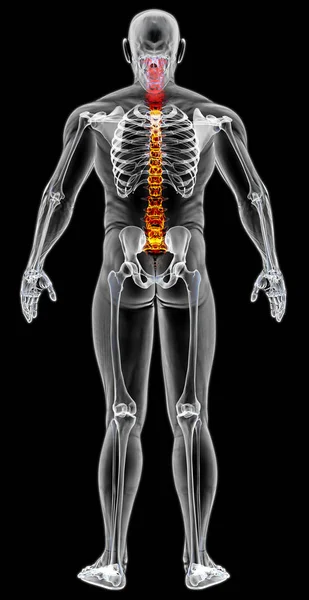 Der Körper des Mannes im Röntgenbild — Stockfoto