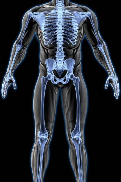 Male body under X-ray — Stock Photo, Image