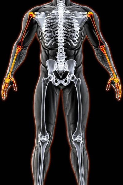 Männlicher Körper im Röntgenbild — Stockfoto