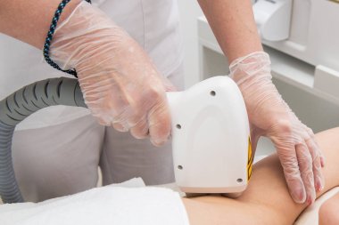 Koltukaltların lazer epilasyonu.